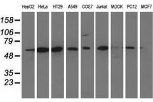 Western blot analysis of extracts (35 µg) from 9 different cell lines by using anti-CD80 monoclonal antibody. (CD80 anticorps)
