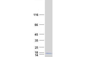 Validation with Western Blot