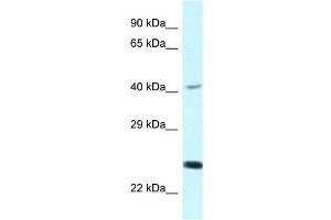 Western Blot showing CD244 antibody used at a concentration of 1 ug/ml against COLO205 Cell Lysate (2B4 anticorps  (C-Term))
