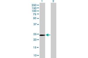 Western Blot analysis of GSTT2 expression in transfected 293T cell line by GSTT2 MaxPab polyclonal antibody. (GSTT2 anticorps  (AA 1-244))