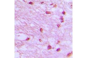 Immunohistochemical analysis of DNA Ligase 4 staining in human brain formalin fixed paraffin embedded tissue section. (LIG4 anticorps  (Center))