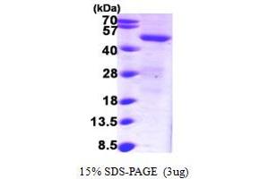 SDS-PAGE (SDS) image for Sorting Nexin 1 (SNX1) (AA 146-522) protein (His tag) (ABIN7529157)