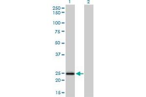 Western Blot analysis of NUDT5 expression in transfected 293T cell line by NUDT5 monoclonal antibody (M04), clone 2A3. (NUDT5 anticorps  (AA 120-219))
