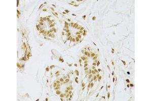 Immunohistochemistry of paraffin-embedded Human breast using SNRPA Polyclonal Antibody at dilution of 1:100 (40x lens).