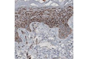 Immunohistochemical staining (Formalin-fixed paraffin-embedded sections) of human skin with CS monoclonal antibody, clone CL2545  shows granular cytoplasmic immunoreactivity in epithelial cells. (CS anticorps)