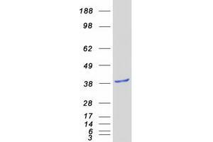 Validation with Western Blot