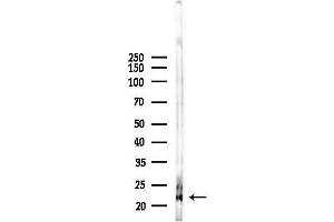 anti-RAB1A, Member RAS Oncogene Family (RAB1A) (C-Term) antibody