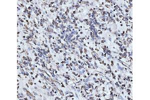 IHC analysis of PDCD4 using anti-PDCD4 antibody (ABIN5518943). (PDCD4 anticorps  (AA 346-446))
