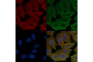 ABIN6260904 and ABIN6272275 staining Hela cells(24h of starvation treatment) by IF/ICC.