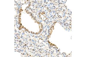 Immunohistochemistry of paraffin-embedded rat lung using TAZ Rabbit pAb (ABIN6130800, ABIN6150278, ABIN6150279 and ABIN6224227) at dilution of 1:50 (40x lens).