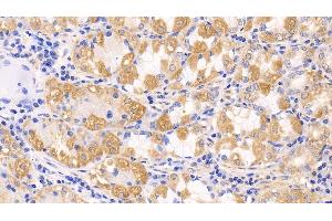 Detection of MCL1 in Human Stomach Tissue using Polyclonal Antibody to Induced Myeloid Leukemia Cell Differentiation Protein Mcl-1 (MCL1)