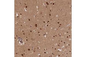 Immunohistochemical staining (Formalin-fixed paraffin-embedded sections) of human cerebral cortex with ADIG polyclonal antibody  shows strong nuclear positivity in glial cells. (ADIG anticorps)