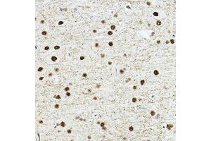 Immunohistochemistry of paraffin-embedded rat brain using TE Rabbit pAb (ABIN6129488, ABIN6148982, ABIN6148984 and ABIN6217332) at dilution of 1:100 (40x lens). (TEAD1 anticorps  (AA 135-215))