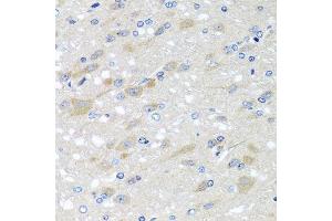 Immunohistochemistry of paraffin-embedded rat brain using NDUFS3 antibody. (NDUFS3 anticorps  (AA 37-264))