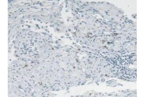 IHC-P analysis of Mouse Lung Tissue, with DAB staining. (CMA1 anticorps  (AA 9-247))