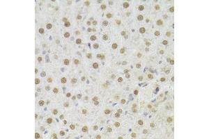 Immunohistochemistry of paraffin-embedded rat liver using HDGF Antibody. (HDGF anticorps  (AA 1-240))