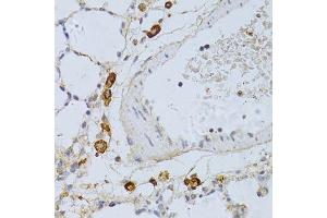 Immunohistochemistry of paraffin-embedded rat lung using PHGDH antibody. (PHGDH anticorps  (AA 264-533))