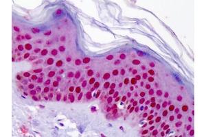 Human Skin: Formalin-Fixed, Paraffin-Embedded (FFPE)