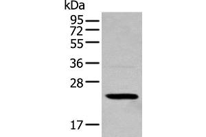 Western blot analysis of 293T cell using TCEAL4 Polyclonal Antibody at dilution of 1:250 (TCEAL4 anticorps)