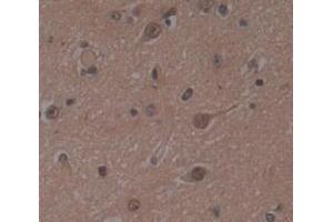 IHC-P analysis of Human Tissue, with DAB staining. (MAPK14 anticorps  (AA 19-279))