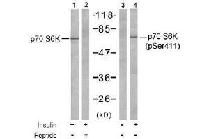 Image no. 2 for anti-Ribosomal Protein S6 Kinase, 70kDa, Polypeptide 1 (RPS6KB1) (pSer411) antibody (ABIN197035) (RPS6KB1 anticorps  (pSer411))