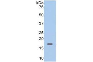 Myoglobin (MB) ELISA Kit