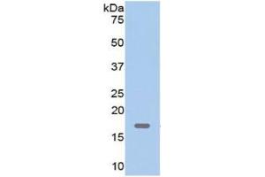 WB of Protein Standard: different control antibodies  against Highly purified E. (Myoglobin Kit ELISA)