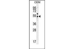 Western blot analysis of PSMAL Antibody (C-term) in CEM cell line lysates (35ug/lane). (FOLH1B anticorps  (C-Term))