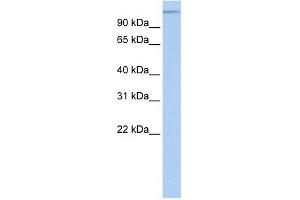 MTUS1 antibody used at 1 ug/ml to detect target protein. (MTUS1 anticorps  (Middle Region))