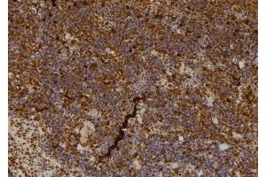 ABIN6266579 at 1/100 staining Mouse spleen tissue by IHC-P. (NOS2 anticorps  (C-Term))