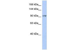 NEK9 antibody used at 1 ug/ml to detect target protein. (NEK9 anticorps)
