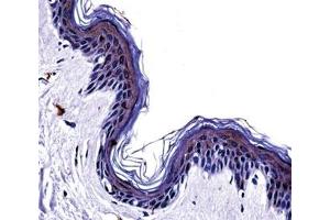 Tyrosinase antibody immunohistochemistry analysis in formalin fixed and paraffin embedded human skin tissue.