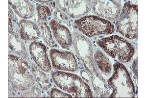 Image no. 3 for anti-C-Type Lectin Domain Family 4, Member E (CLEC4E) antibody (ABIN1497530)