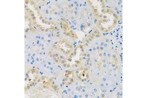Immunohistochemistry of paraffin-embedded rat kidney using DNAL1 antibody at dilution of 1:100 (x40 lens). (DNAL1 anticorps)