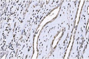 IHC analysis of SUN2 using anti-SUN2 antibody (ABIN7601278). (SUN2 anticorps  (AA 31-695))