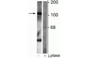 Western blot of rat synaptic membrane lysate showing specific immunolabeling of the ~102 kDa GABAB R1 protein phosphorylated at Ser923 in the first lane (-). (GABBR1 anticorps  (pSer923))