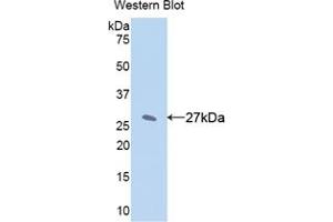 Western blot analysis of the recombinant protein. (CYP1A2 anticorps  (AA 2-231))