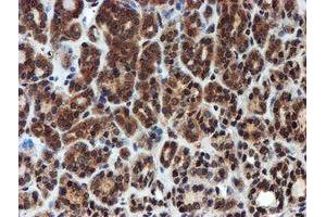 Image no. 5 for anti-Proteasome Subunit alpha 6 (PSMA6) antibody (ABIN1500463)