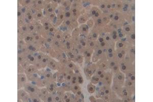 Used in DAB staining on fromalin fixed paraffin- embedded liver tissue