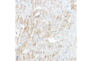 anti-Pyruvate Dehydrogenase Kinase, Isozyme 4 (PDK4) (AA 102-411) antibody