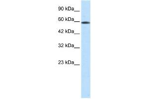 WB Suggested Anti-ASH2L Antibody Titration:  0.