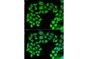 Immunofluorescence analysis of U2OS cells using TIMP4 antibody.