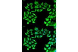 Immunofluorescence analysis of U2OS cells using TIMP4 antibody. (TIMP4 anticorps  (AA 30-224))