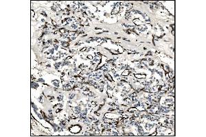 IHC analysis of TAGLN/Transgelin using anti-TAGLN/Transgelin antibody (ABIN7600099).