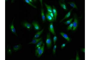Immunofluorescence staining of Hela cells with ABIN7143601 at 1:133, counter-stained with DAPI. (AGRN anticorps  (AA 968-1130))