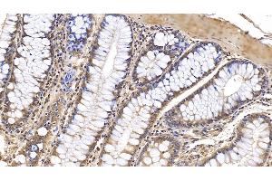 Detection of IL1RA in Human Colon Tissue using Monoclonal Antibody to Interleukin 1 Receptor Antagonist (IL1RA)
