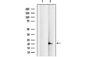 Western blot analysis of lysates from MCF7, using ADI1 Antibody.