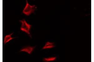 ABIN6275776 staining Hela by IF/ICC. (IL18R1 anticorps  (Internal Region))