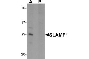 Western blot analysis of SLAMF1 in rat colon tissue lysate with SLAMF1 antibody at 1 µg/mL in (A) the absence and (B) the presence of blocking peptide. (SLAMF1 anticorps  (N-Term))
