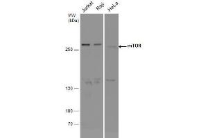 WB Image mTOR antibody detects mTOR protein by western blot analysis. (MTOR anticorps  (Internal Region))